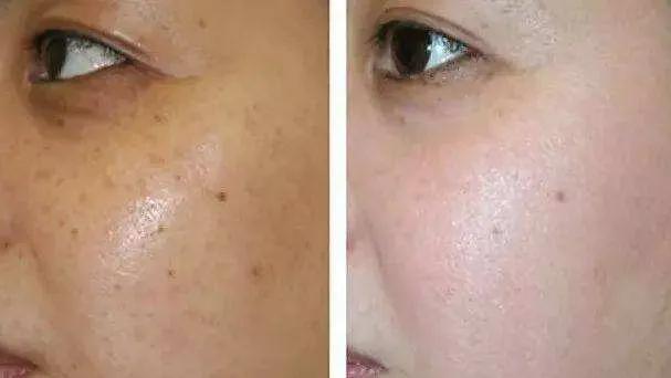 真正有效的美白祛斑产品,美白祛斑产品是个坑吗