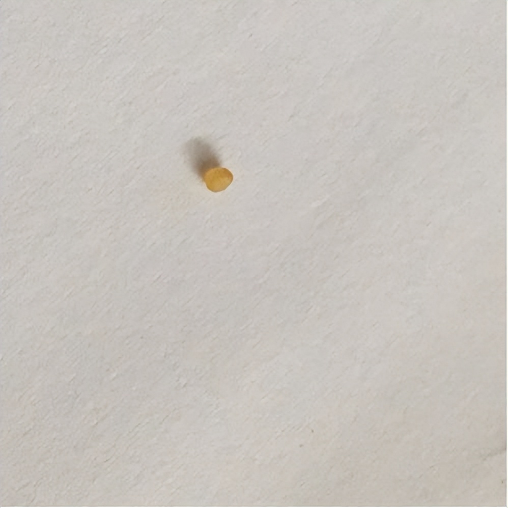 为什么鼻子可以挤出很大的黑头,用夹子挤出鼻子黑头