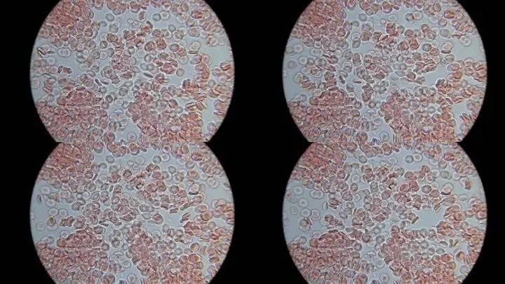 非洲硬舌异口尼罗河的日粮广度变化：对物种保护和水产养殖的影响