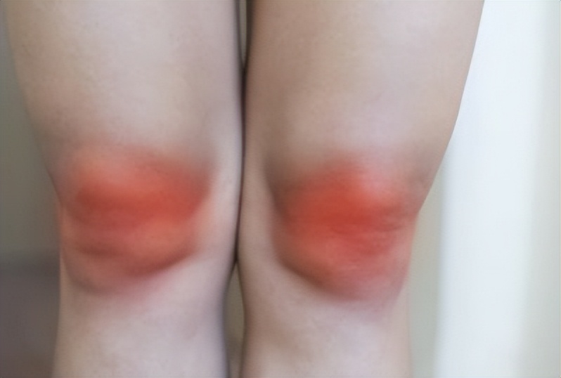 小小六味地黄丸，可调理女性更年期4种常见问题，牢记3点安全使用