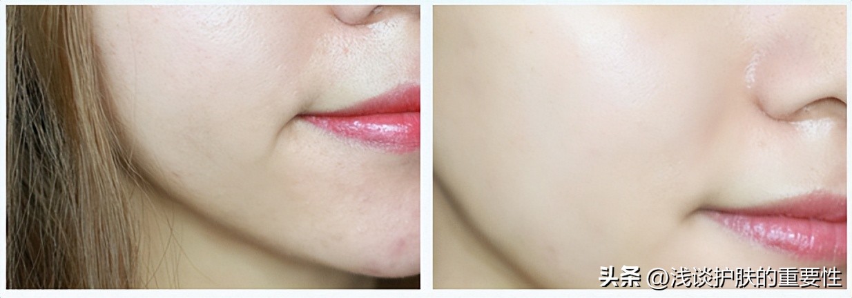 敏敏肌护肤秘籍你get到了吗,敏敏肌可以护肤吗
