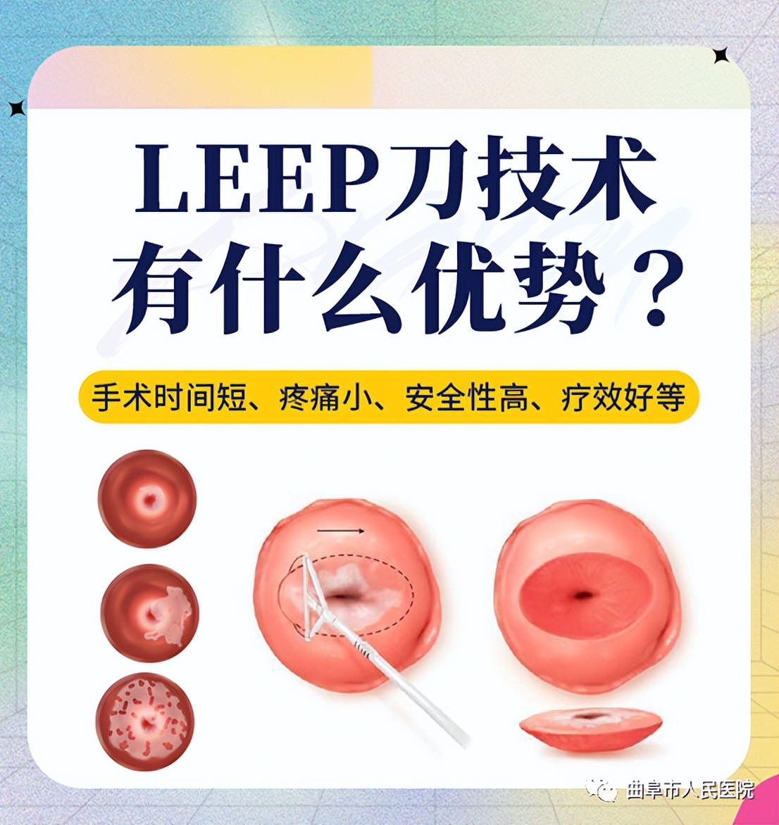 宫颈物理治疗leep刀,宫颈leep刀后病理显示慢性宫颈炎