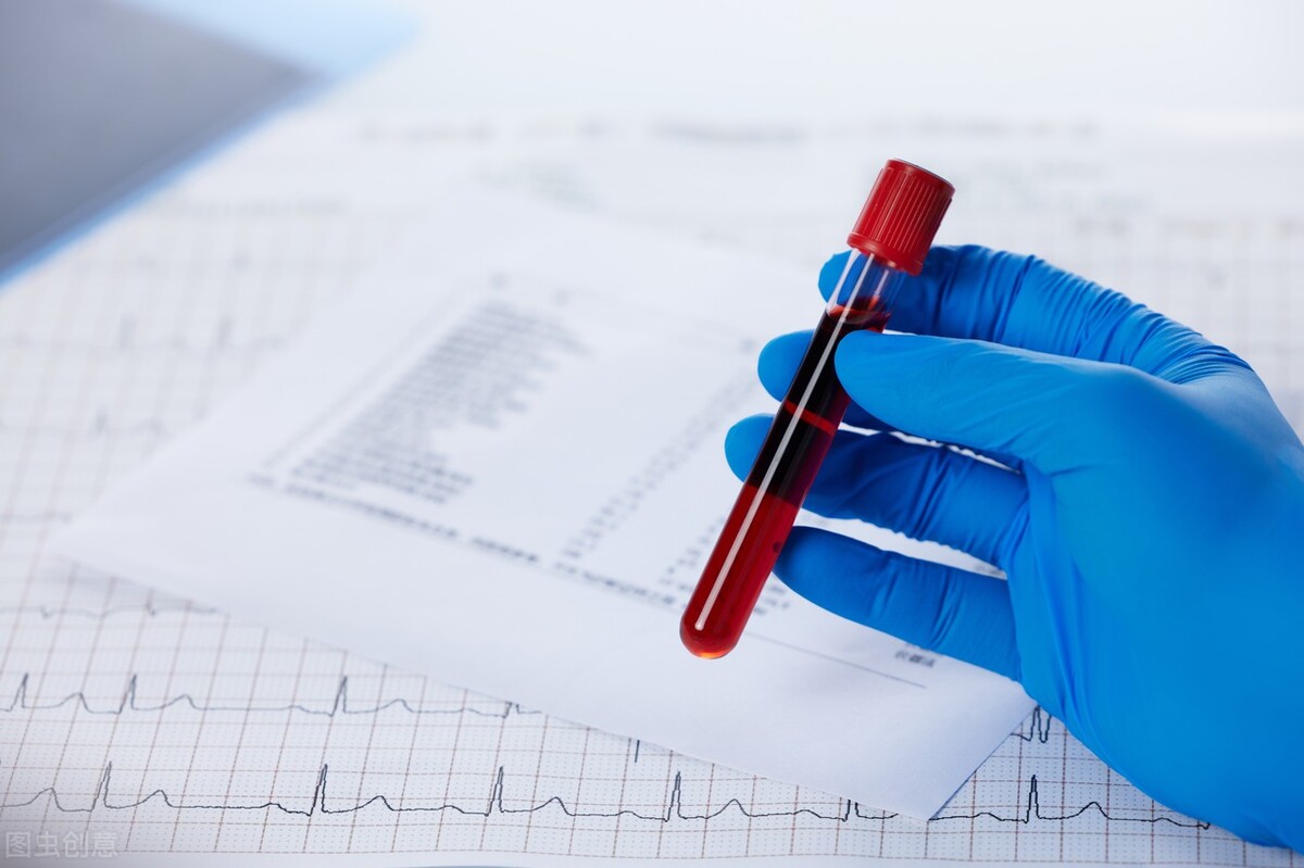 体检显示心率慢意味着什么,体检报告心跳过快