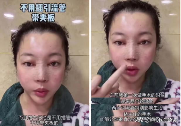 花了几万块钱做的鼻子,花上百万做鼻子