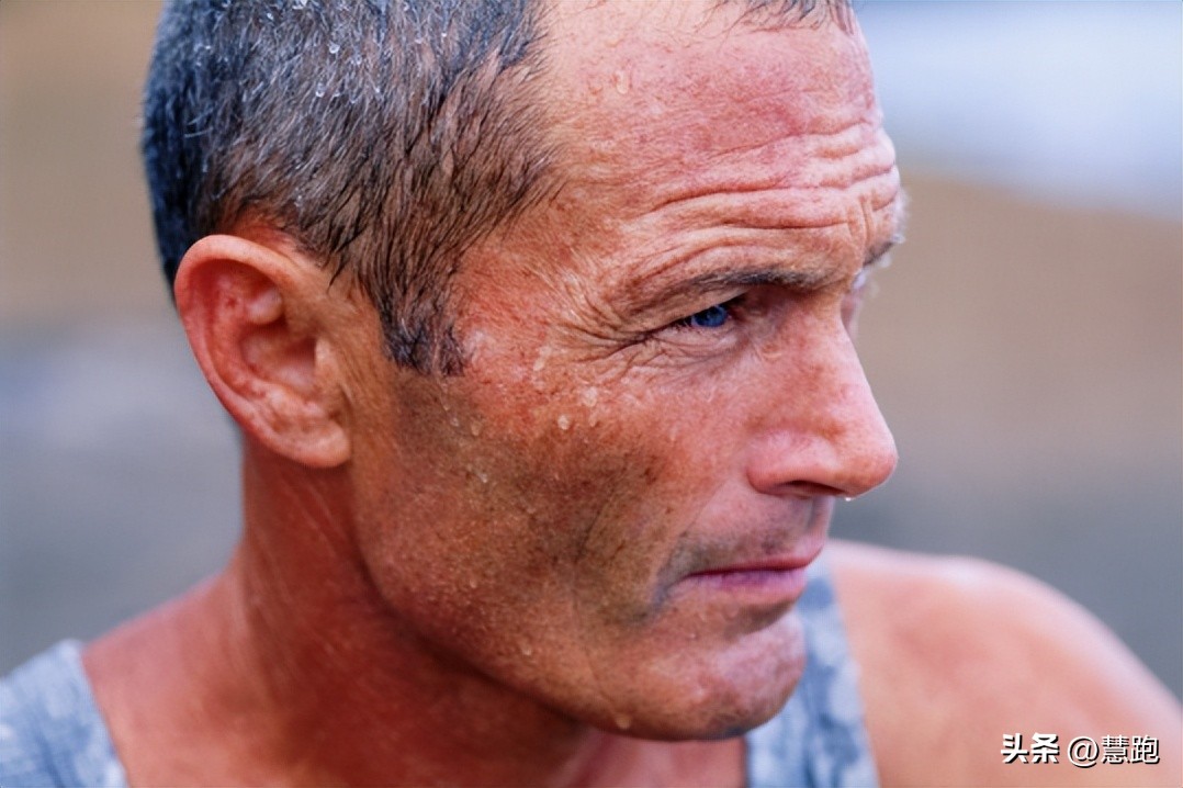 关于出汗的正确说法,出汗多有汗臭的体质怎么调理