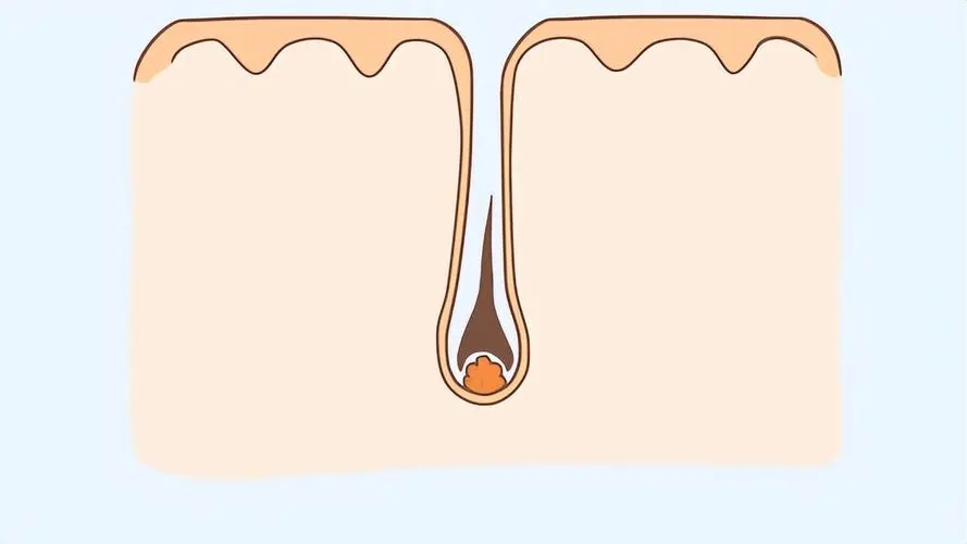 阴毛有什么用，要不要刮掉？阴毛的变化可能暗示什么疾病？望了解