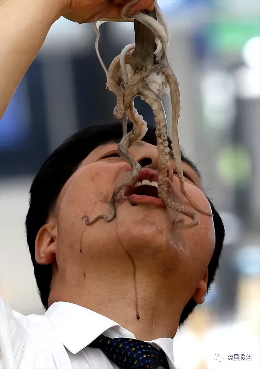 男子吞咽困难狂吐，医生检查吓呆：章鱼卡在体内，触手堵死食道！