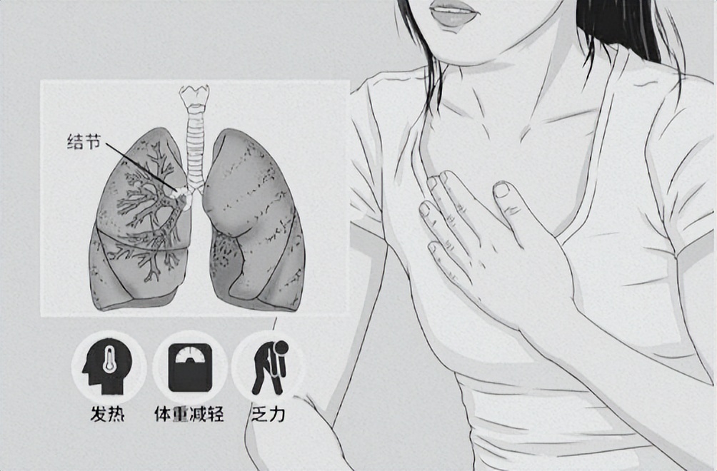 肺结节普通ct与增强ct大小不一样,不同医院肺结节大小误差3mm正常吗