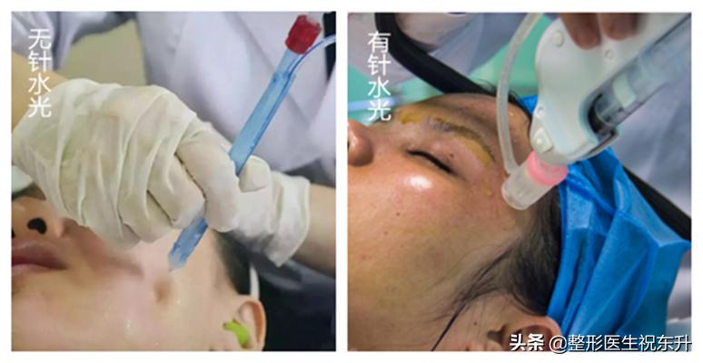 关于水光针的知识解析,水光针的十问十答