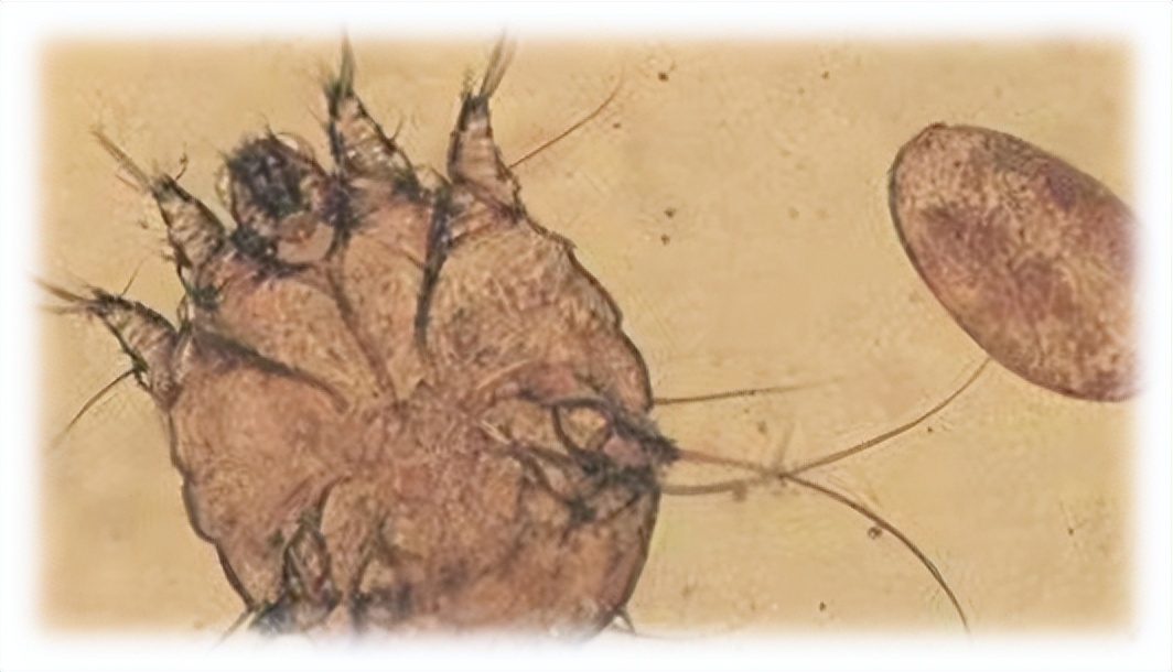 孩子全身痒痒夜间更明显怎么回事,小孩得疥疮为什么抓痒会起一个包