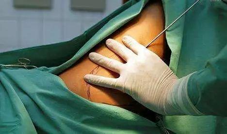 割阴切胃，挑断脚筋，甚至致人死亡，“畸形审美”有多猖狂