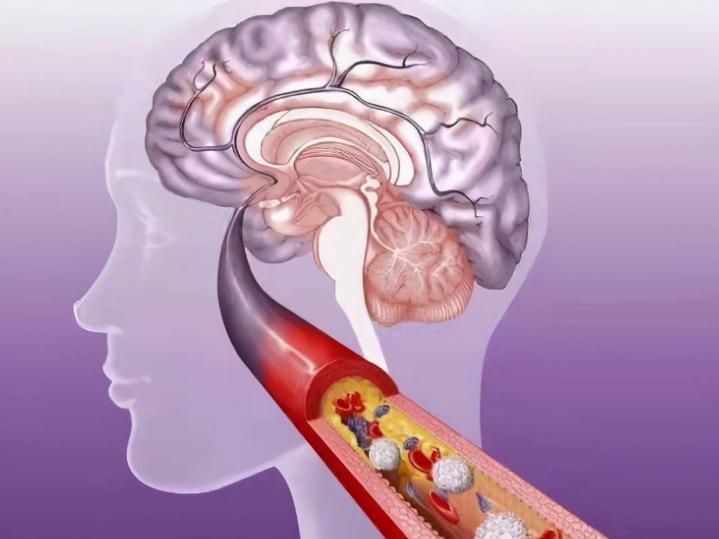 常常“手麻”的人要注意！身体或是出现了4种问题