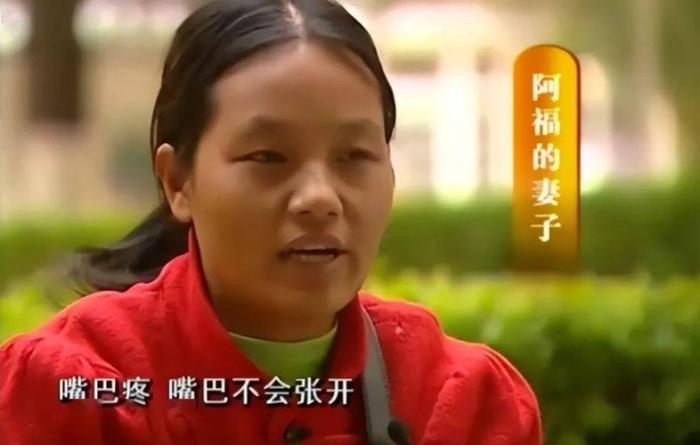 云南男子被妻子按摩到吐血，去医院检查，医生：你脑袋里插了把刀