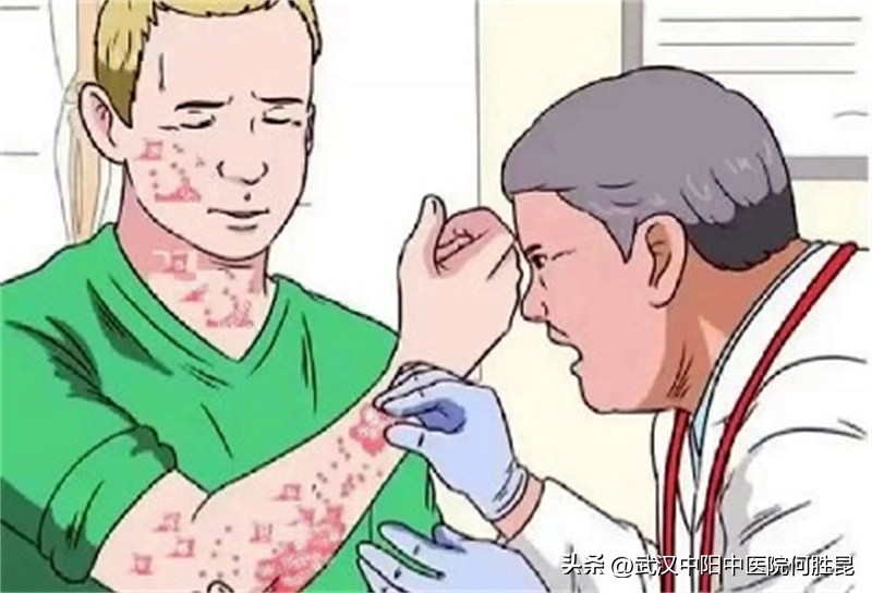 银屑病抹了药后红脱皮是好是坏,银屑病抹药后变红怎么回事