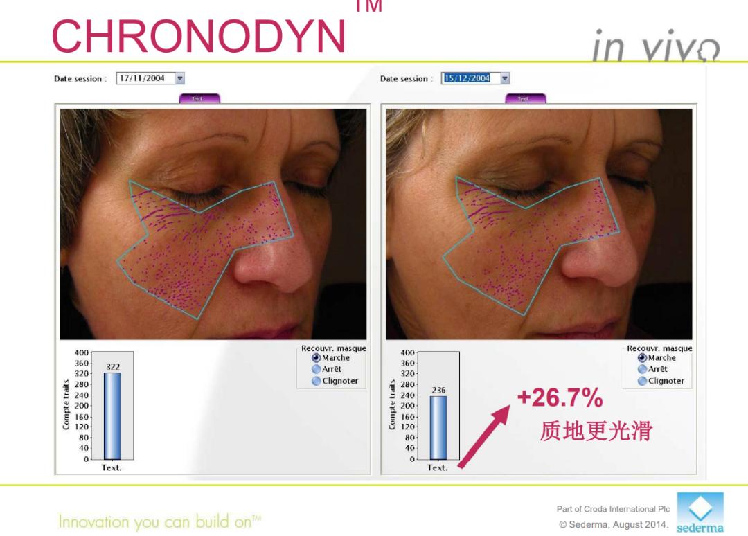 最贵的一瓶护肤品,很昂贵的护肤品