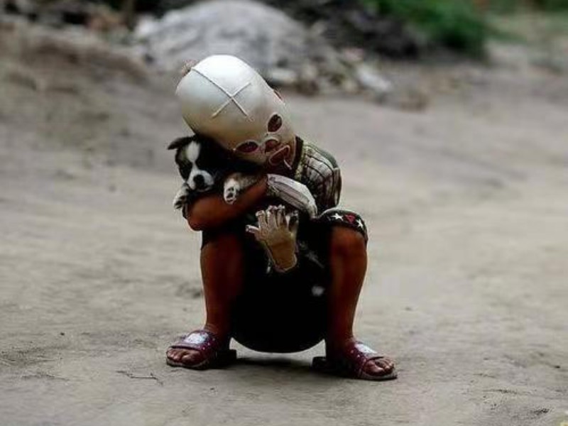 小孩子脸被火烧伤戴着面具,因烧伤带面具的山西小男孩