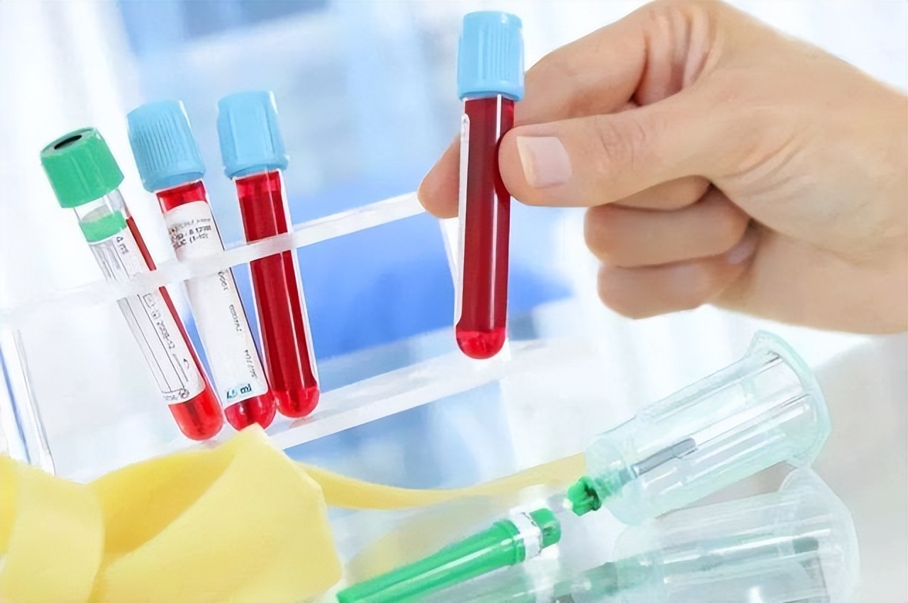 血常规都可以检查出什么病啊,血常规能检查出传染病四项