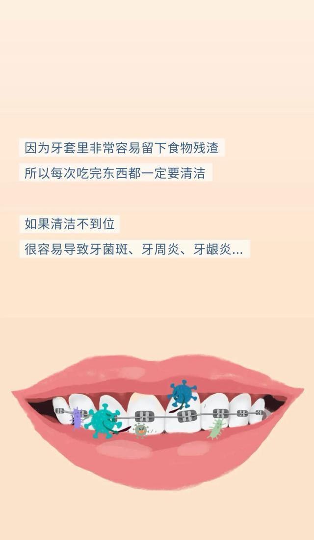 牙套矫正过程漫画,戴牙套是什么体验