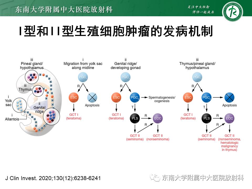 好文分享值得深思,纵隔精原细胞瘤
