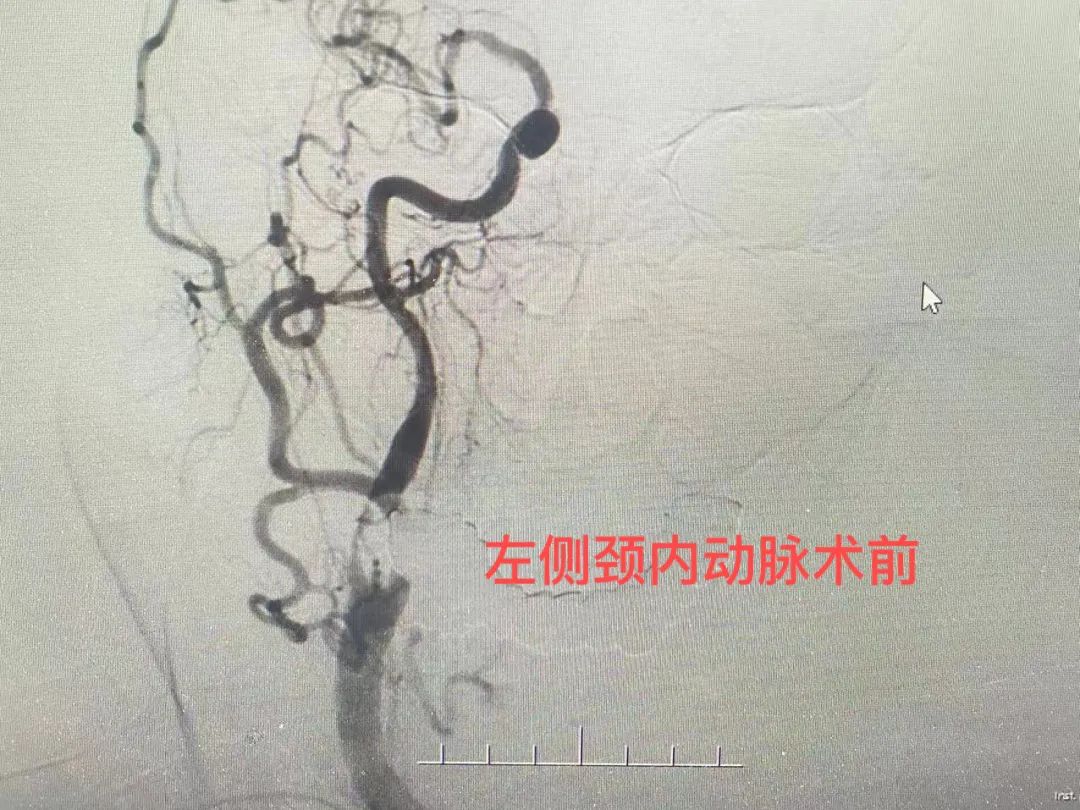 济南市莱芜人民医院口镇分院,山东打通生命通道济南