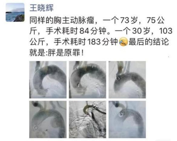 206斤小伙查出胸主动脉瘤如拳头大，专家提醒：胖墩墩”胸口藏“雷”几率高，88%爆雷后2小时内致命