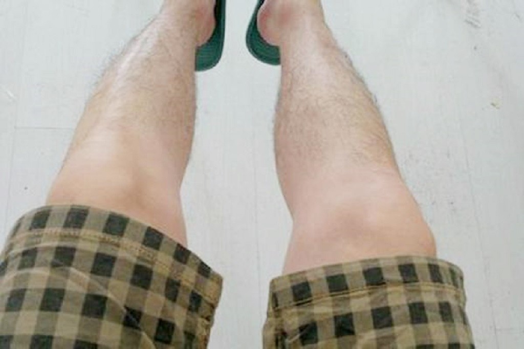 女性这4处毛发旺,中年女性毛发生长旺盛