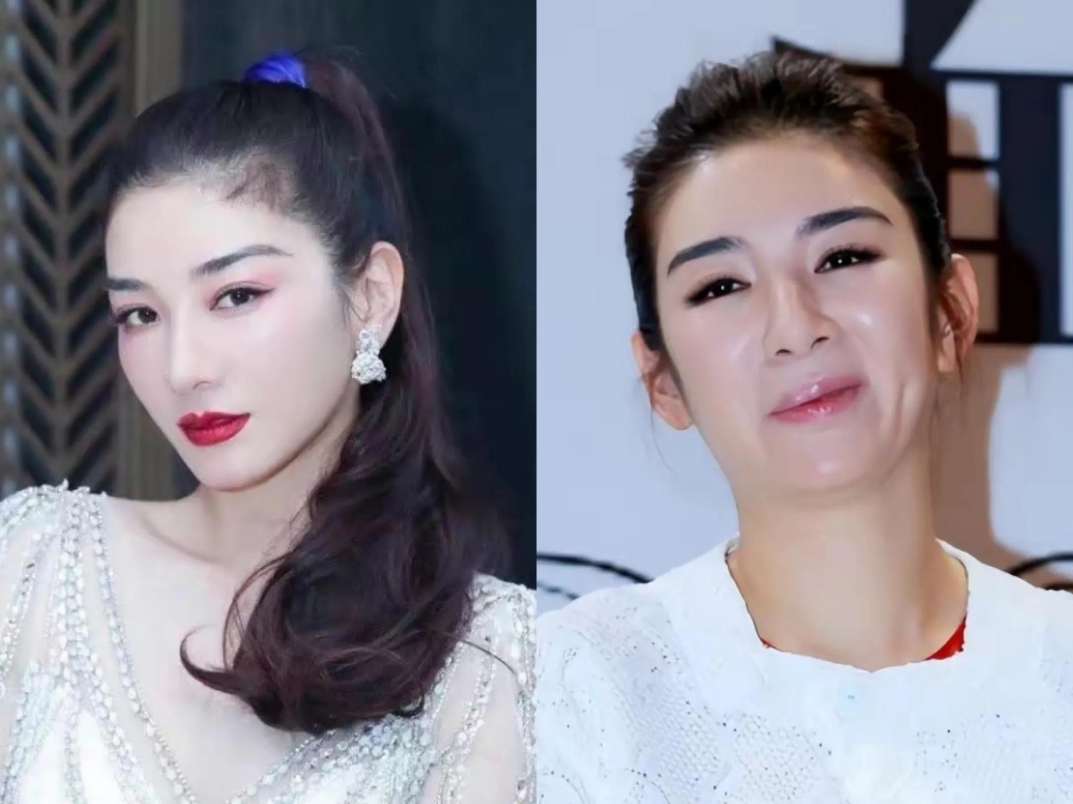 脸没恢复就别出来捞金，发面馒头、蜡像脸，求求你们放过观众吧！