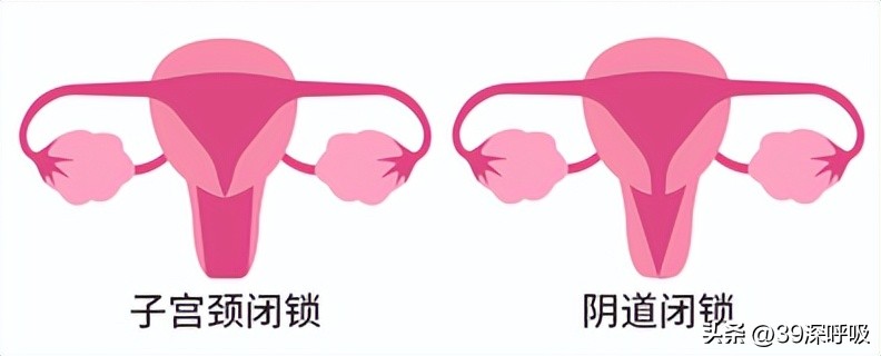 17岁女孩没有来月经,23岁女生从未来过月经能治好吗