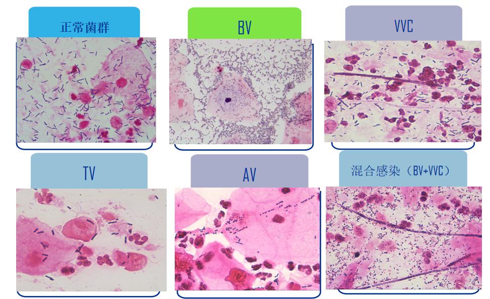 派特灵生物,派特灵生物讲解