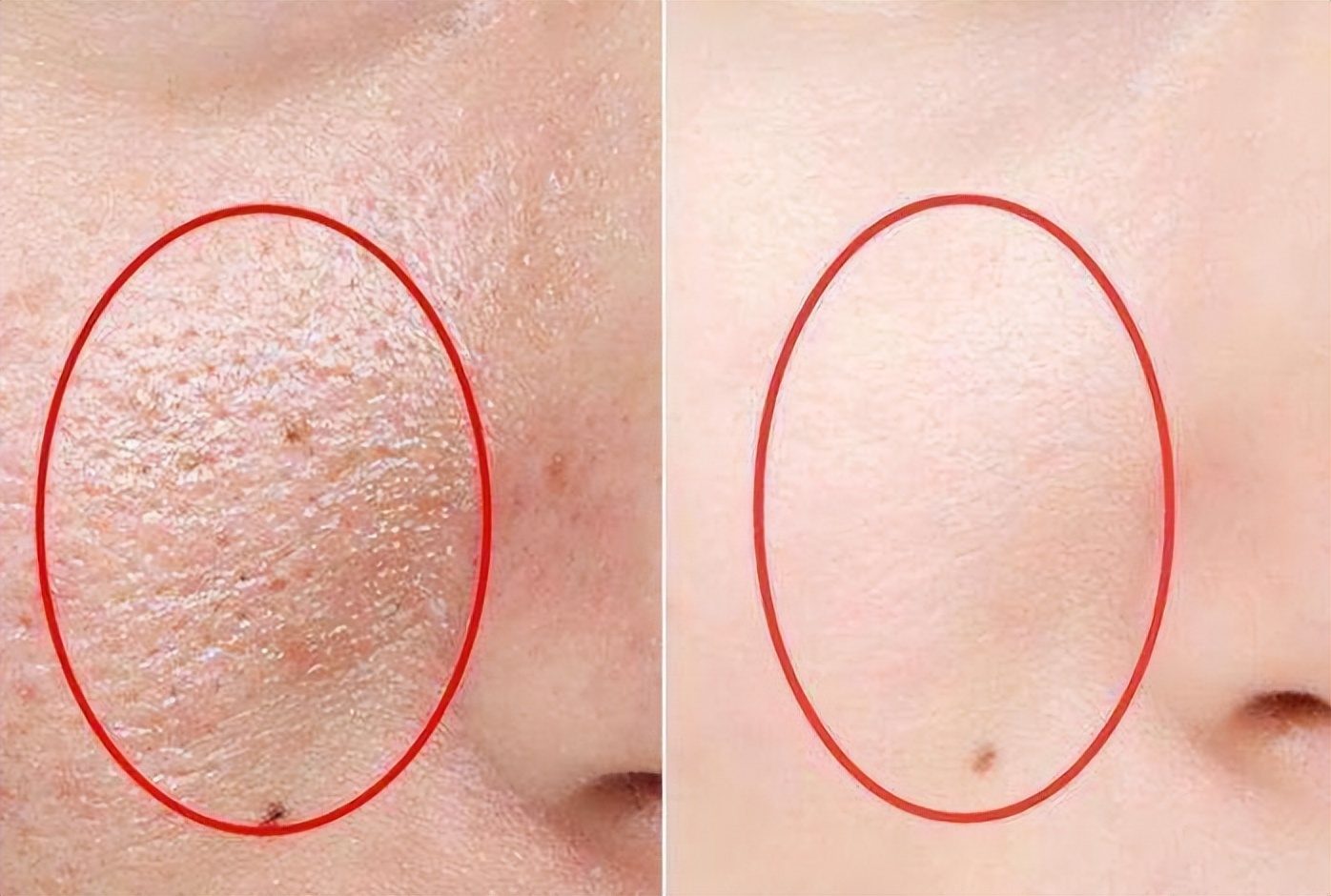 化妆品护肤品真的有用吗,化妆品护肤品各大作用