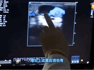 腿上起红肿大包疼,快告诉爸妈碰到这些人要当心