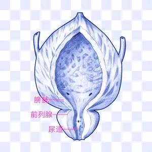 前列腺增生轻度中度超声怎么区分,前列腺增生psa要怎么查