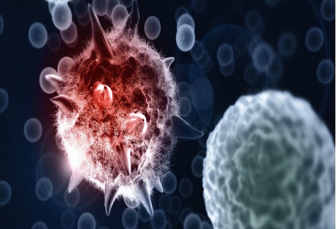 早期宫颈癌最有价值的检查,早期宫颈癌妇科检查都会出血吗