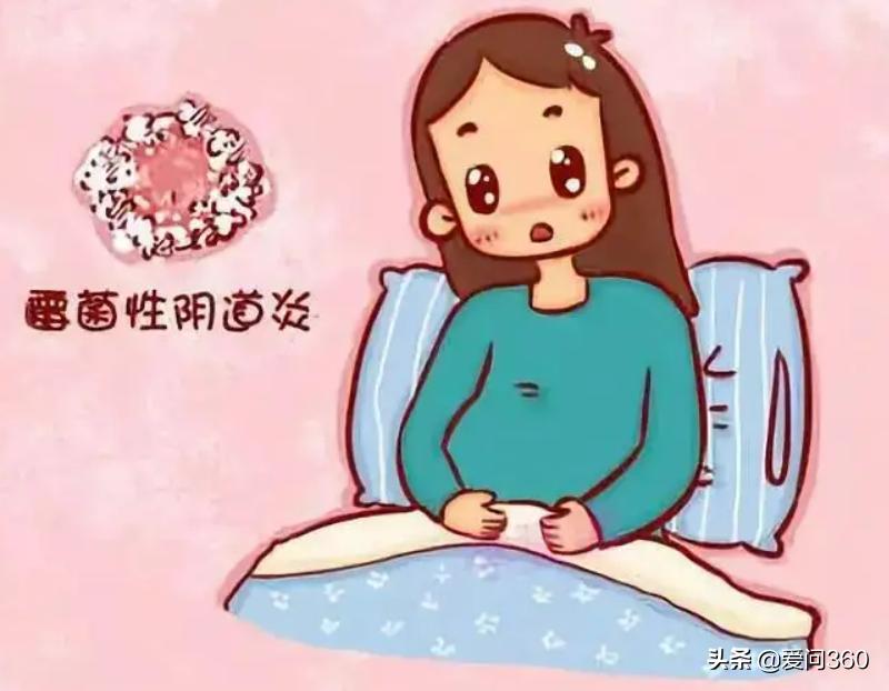 阴道炎刚开始会有什么症状,阴道炎来前症状