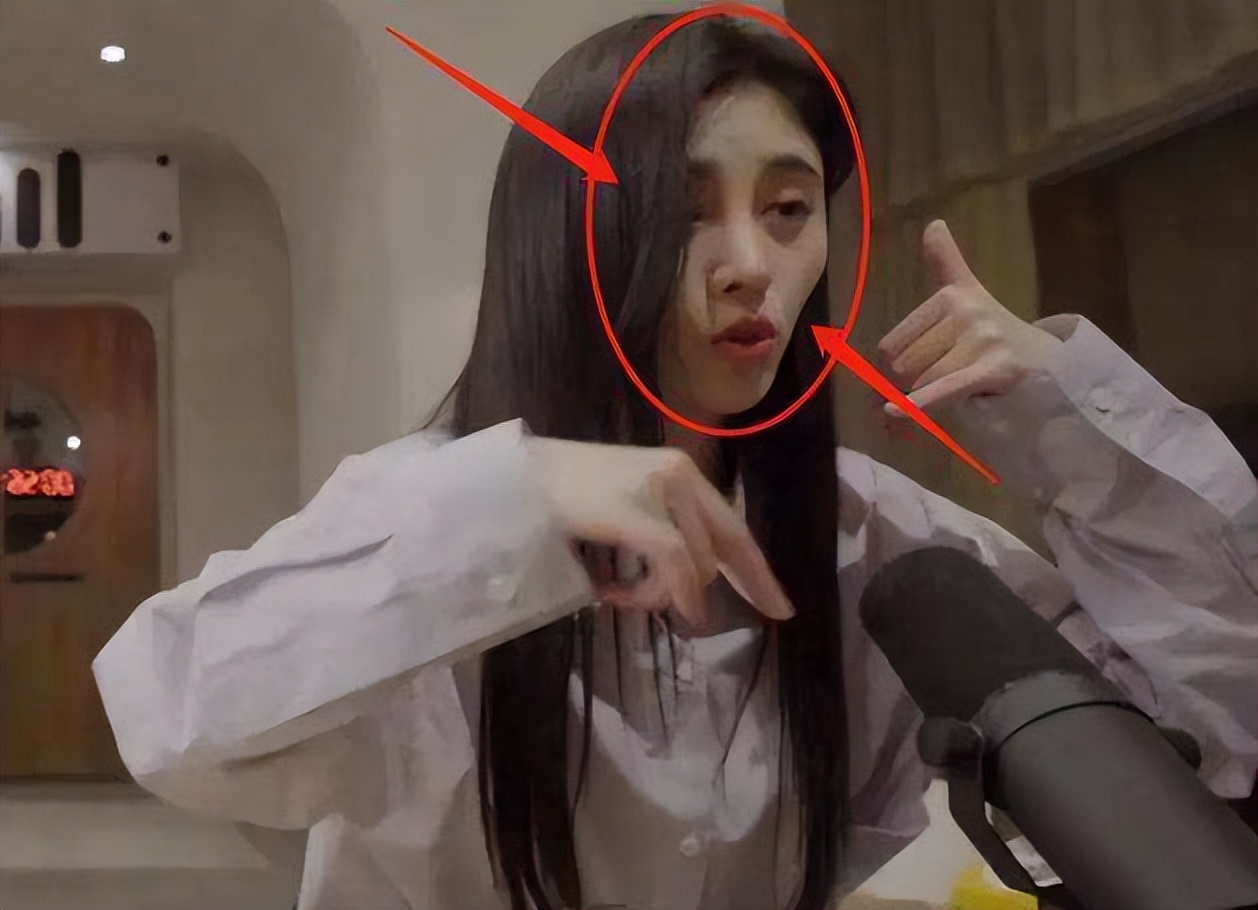 哪些明星整容后遗症越来越严重,整容明星后遗症对比图片