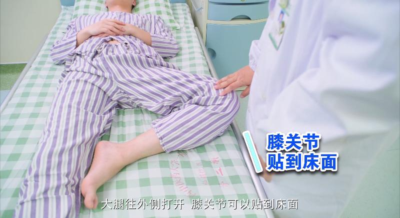 科普丨八桂中医大讲堂（41）：如何预防股骨头坏死
