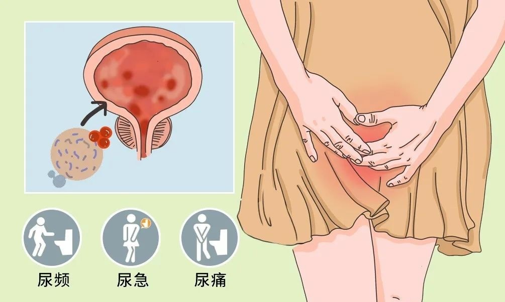 精神一紧张就想上厕所怎么回事,坐车紧张焦虑要上厕所怎么办