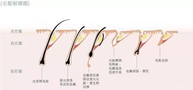 到底有没有必要买脱毛仪,市场上的脱毛仪真的有用吗