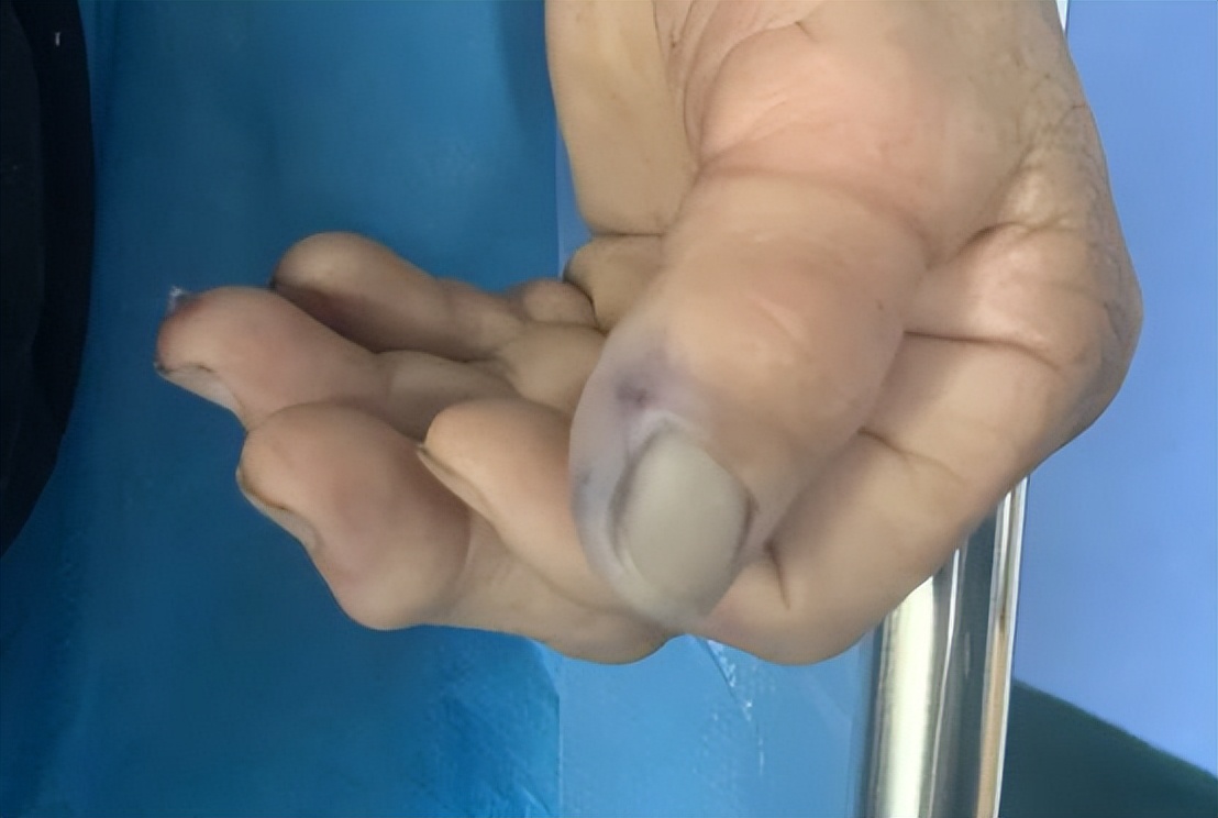 小伙徒手抓竹叶青后续,胆大的小伙用毒蛇咬了会怎么样