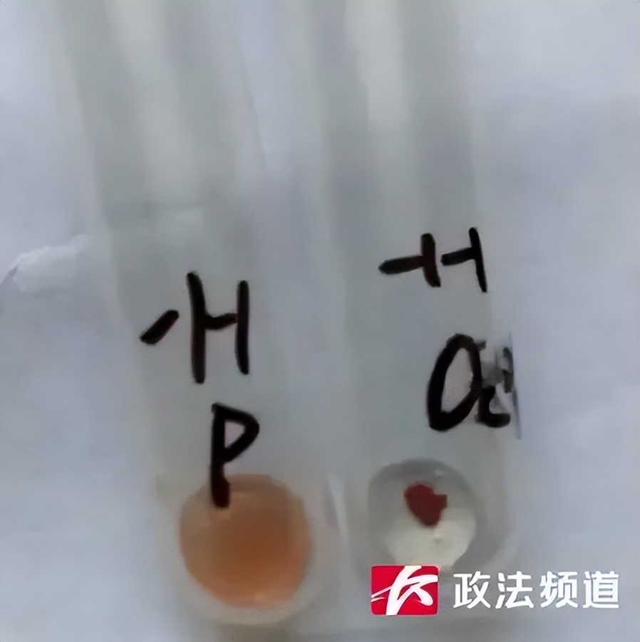 比孟买血型更稀有的血,孟买最稀有的血型