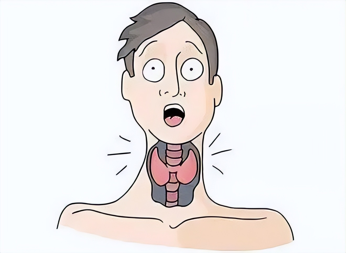 得甲亢眼突后怎么治好,甲亢引起的眼突怎么治疗效果最好