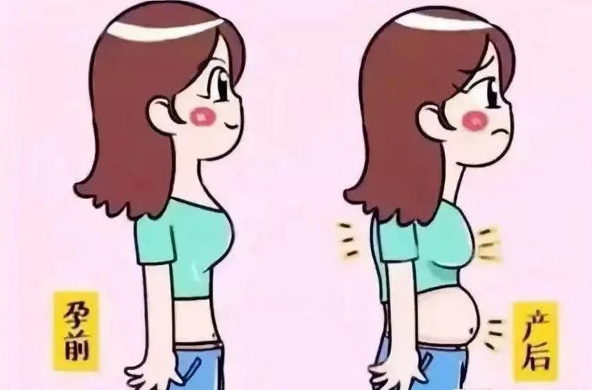 妇幼保健院有腹直肌分离修复吗,市妇幼腹直肌分离修复