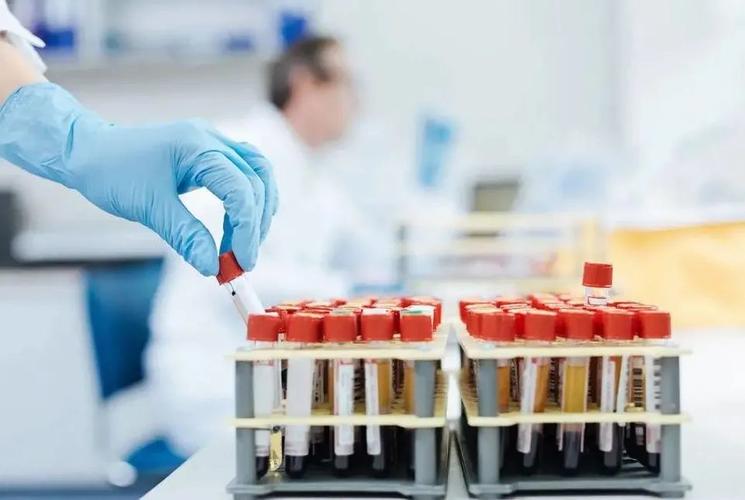 血常规最怕三种指标偏高一点点,血常规检查各项指标都高什么原因