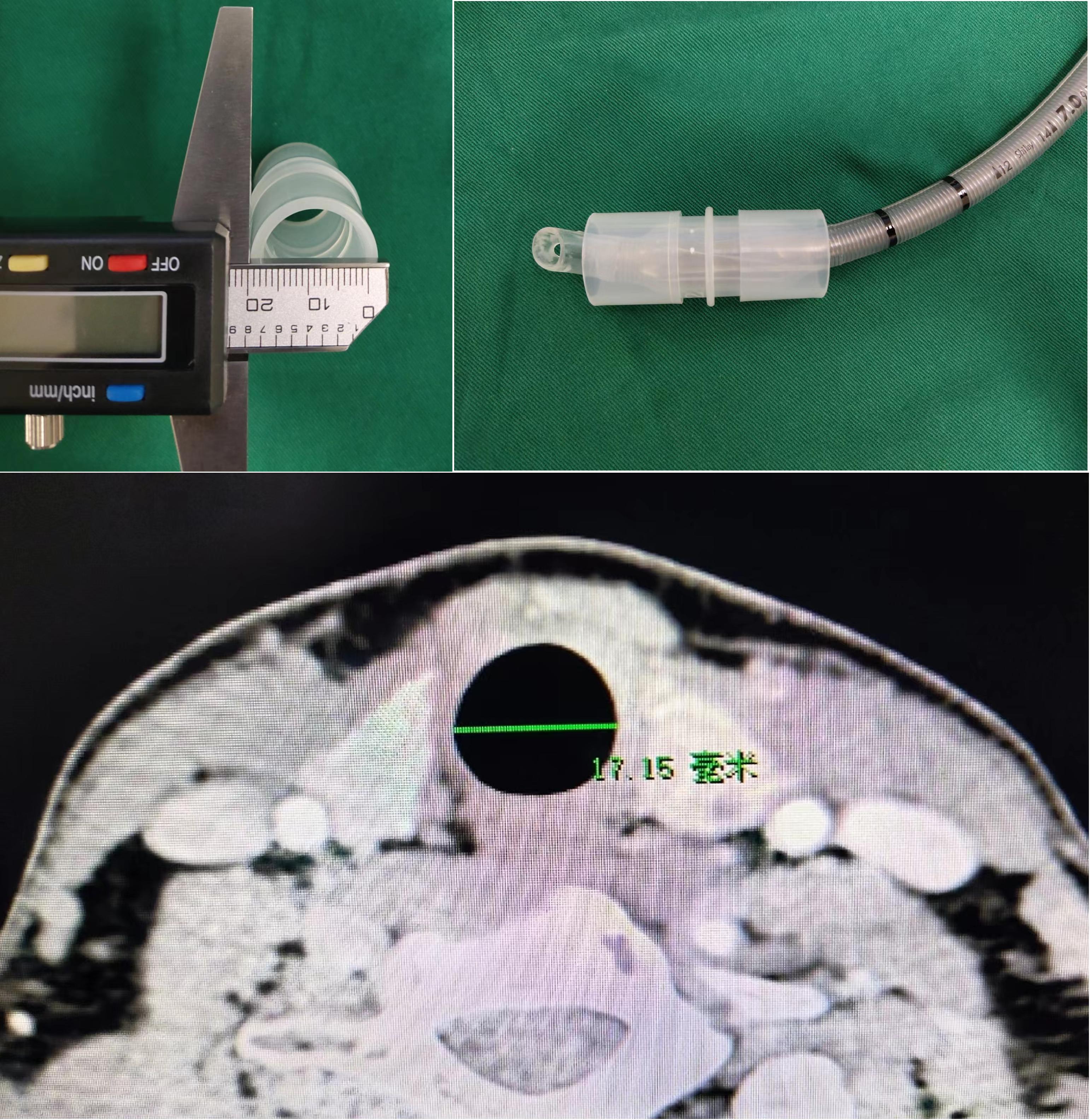 5ml注射器进针手法,5ml注射器怎么用