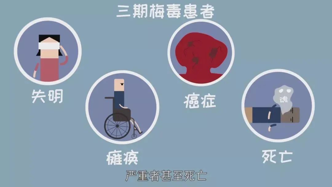 大学时感染梅毒,梅毒感染医学生