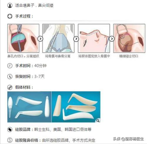 隆鼻怎么做才自然又安全,隆鼻小知识视频