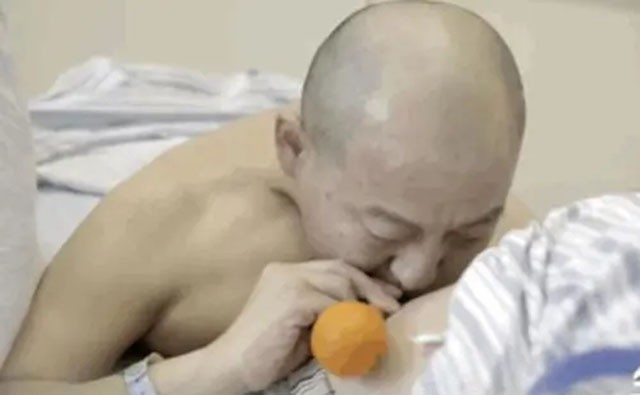 折叠人李华后续,折叠人李华四次手术完整版