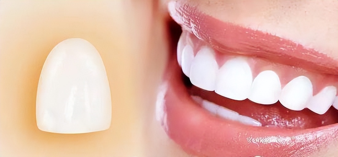 牙齿美白真相大揭秘,牙齿黄怎么美白