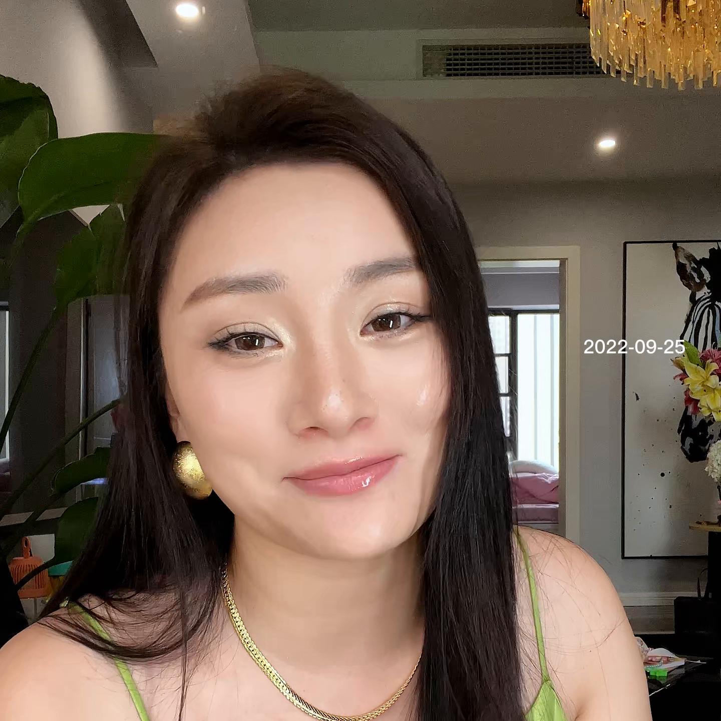 孩子13岁牙齿反颌矫正最佳方案,4岁宝宝牙齿反合矫正过程