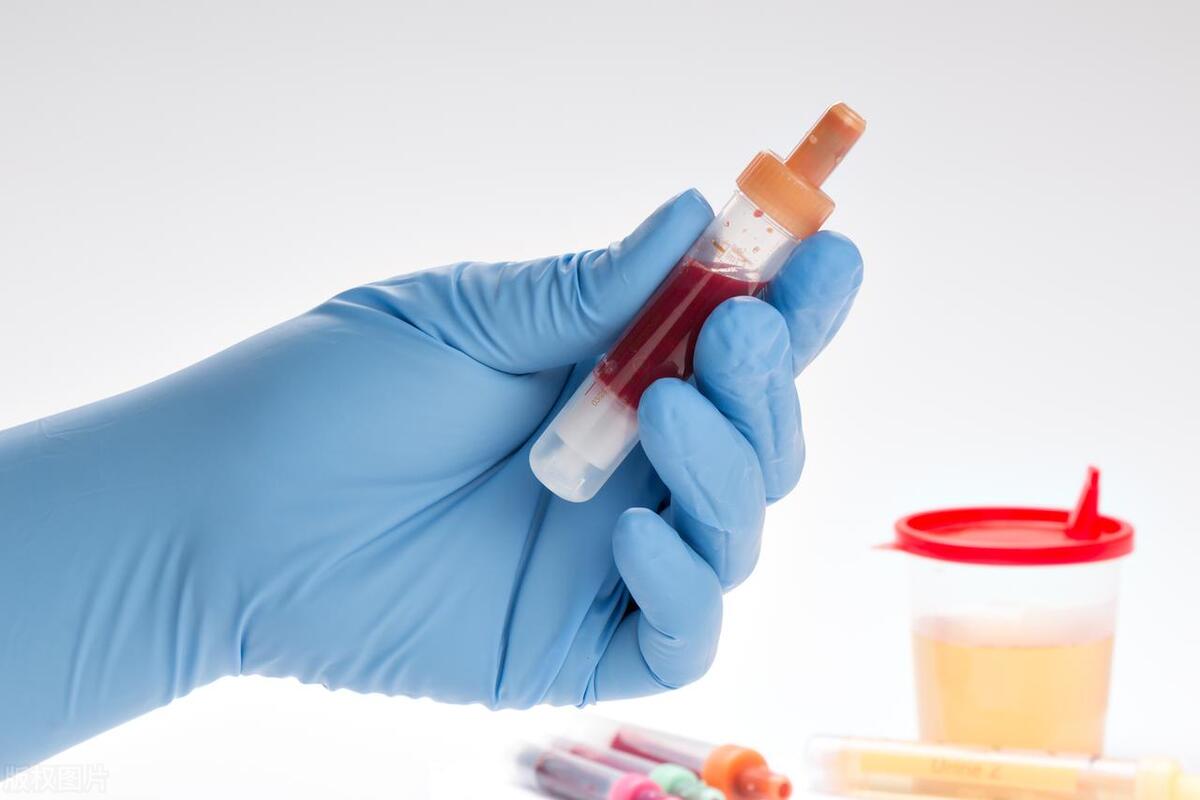 只有女人在亲热时会出血，难道男人就不会出血吗？8个因素要注意